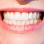 Dzisiejsza technika wykorzystywana w salonach stomatologii estetycznej może spowodować, że odzyskamy śliczny uśmiech.